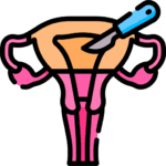 hysterectomy
